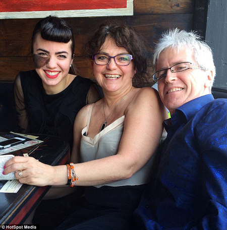 【满满的正能量】美女舞者脸上有块巴掌大的胎记,别人让她整容,但她